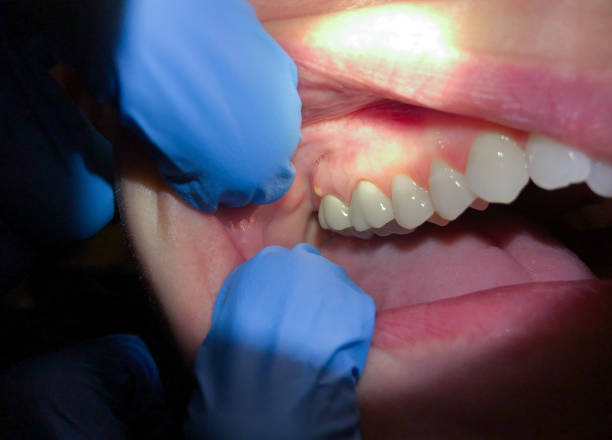 Best Broken or Chipped Tooth Repair in Goldenrod, FL